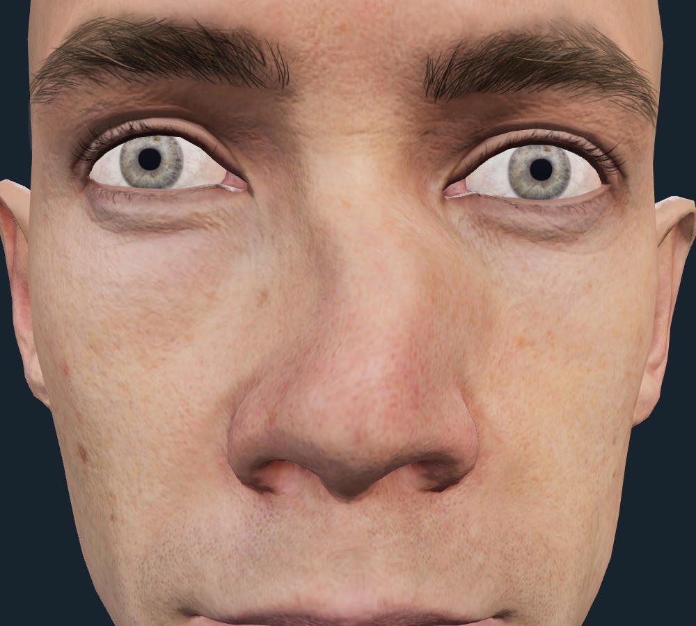 Supplied teaching image for Localise the Deformity