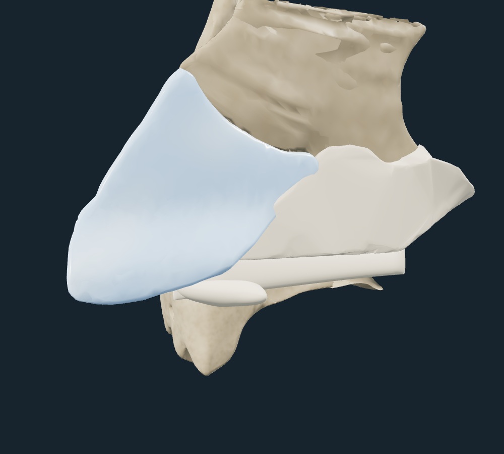 Supplied teaching image for Displacement or Loss of Support?
