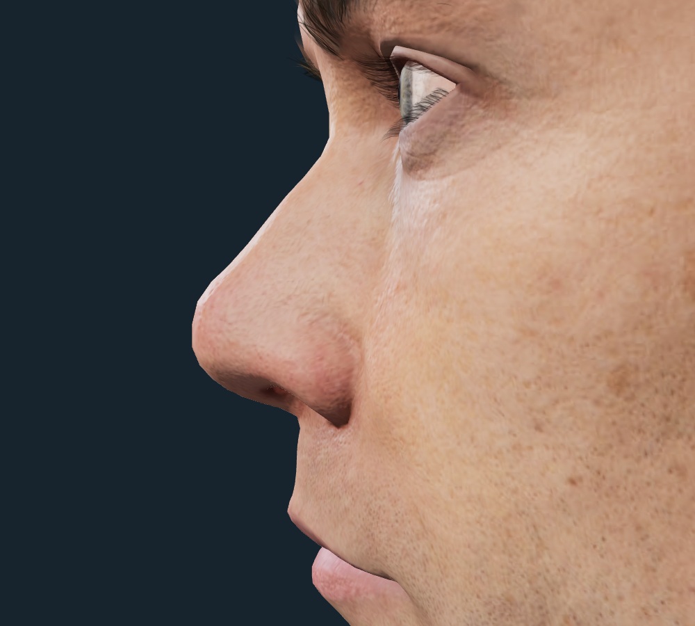 Starting model profile, from the supplied teaching activity